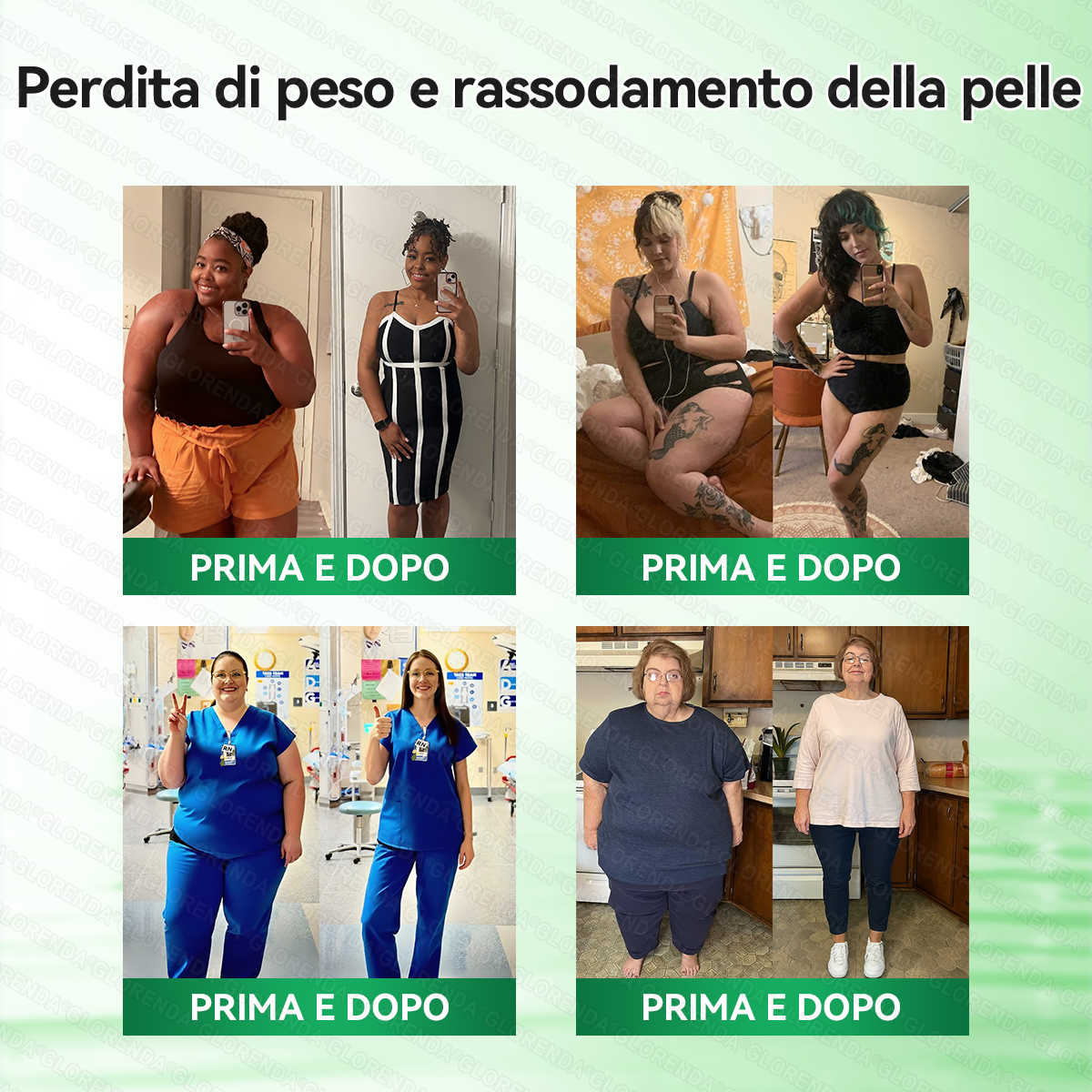 🇮🇹Store Ufficiale Slimora® Moringa · Berberina × NAD+ microneedle nano